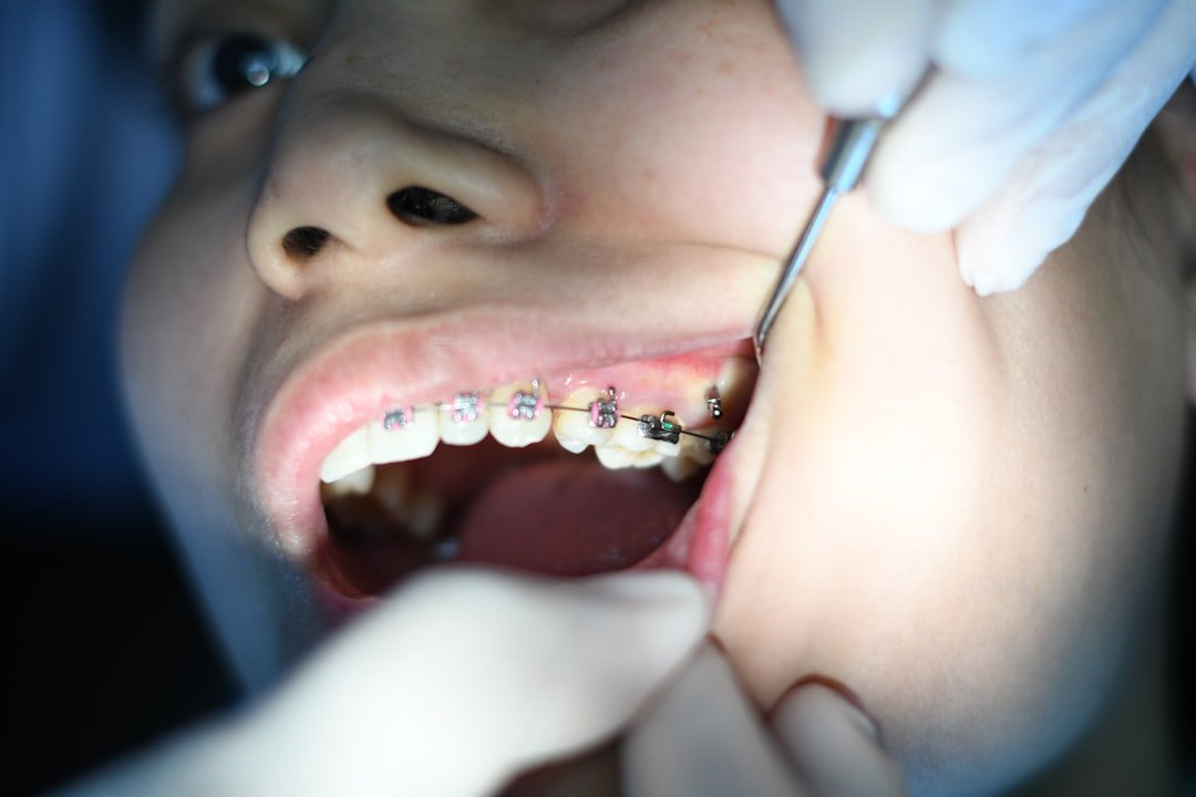 Child receiving orthodontic treatment with braces, showing dental tools and focus on oral care at Arista Dental Care in Edmonds.